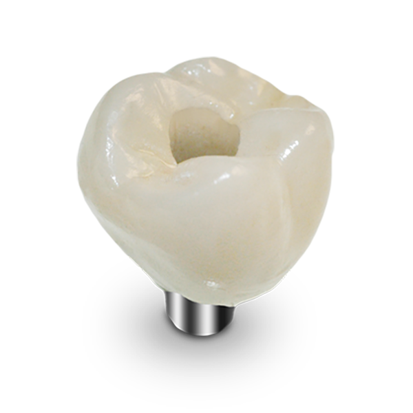 Screw Retained Crown