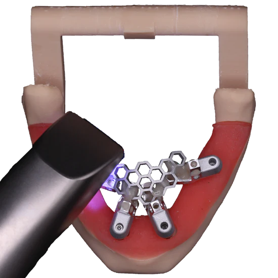 Screw Retained Crown